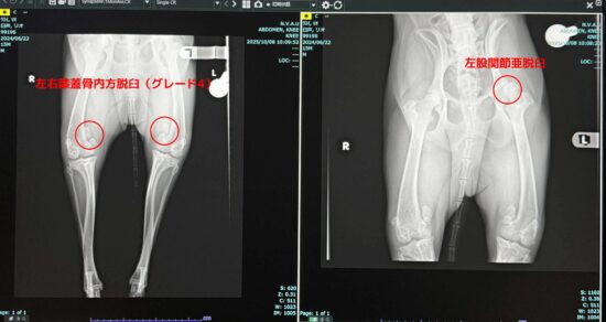 左右膝蓋骨内方脱臼のレントゲン画像