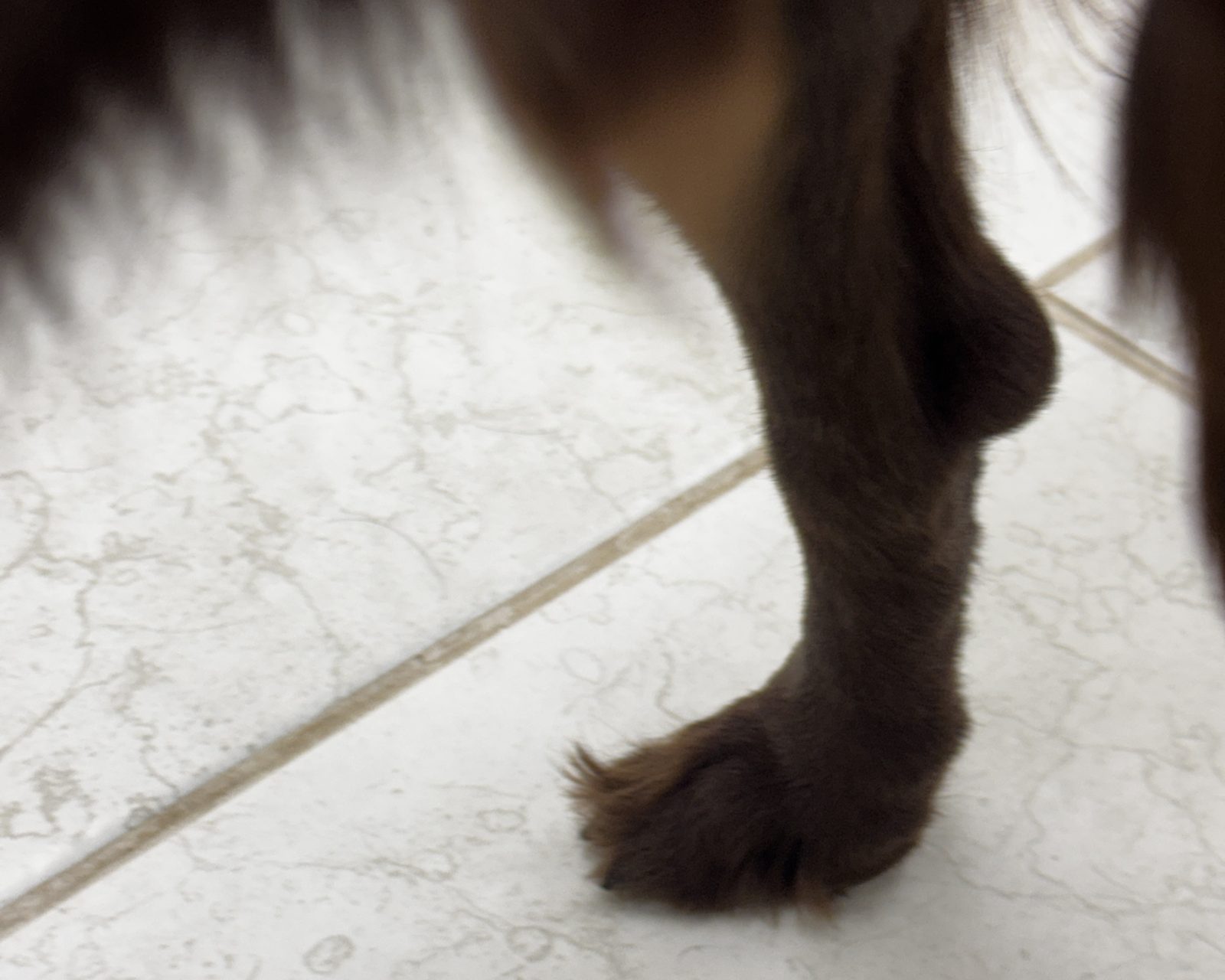 右脚のかかとの腫れ